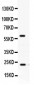 Anti-Rab11A Picoband Antibody